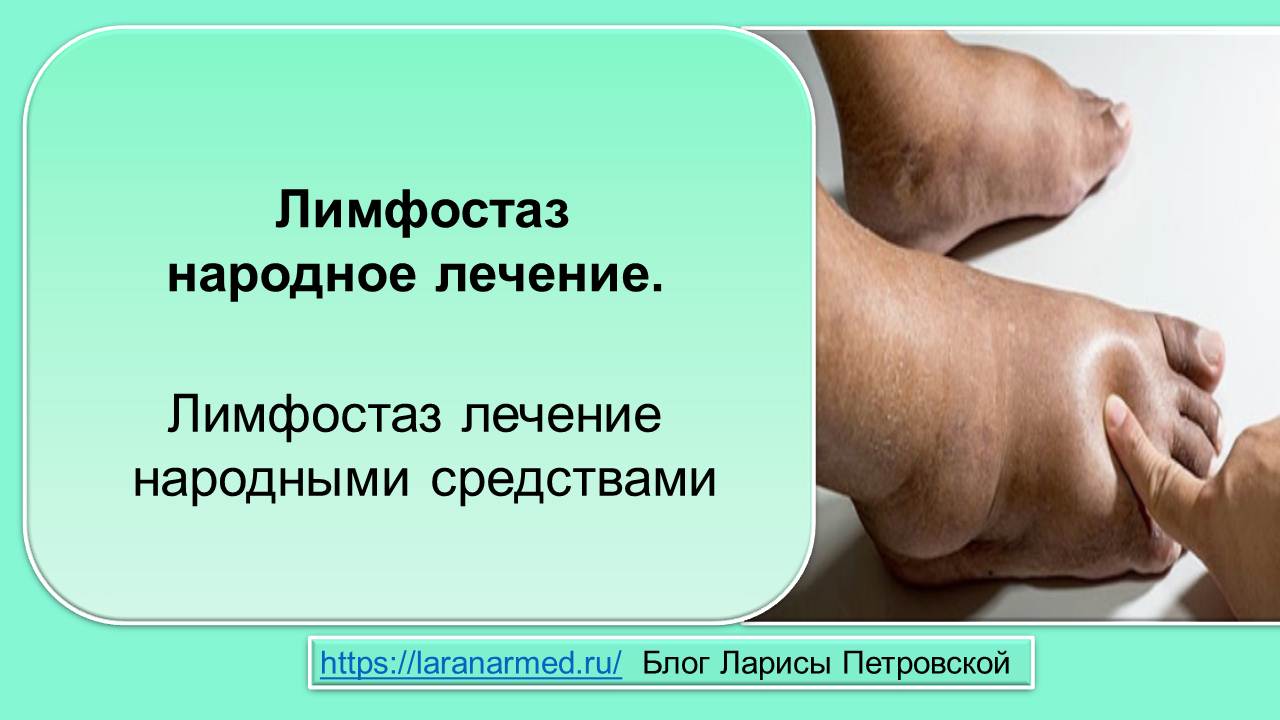 Лимфостаз народное лечение