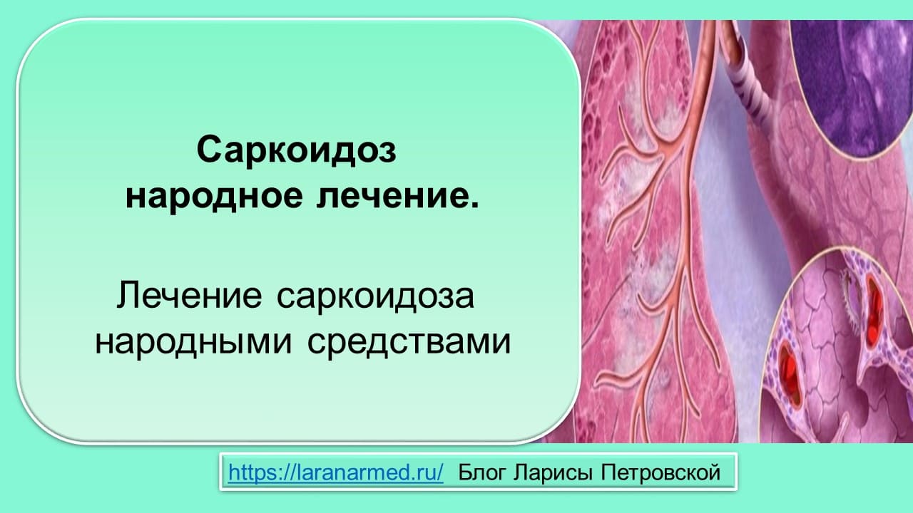 Саркоидоз народное лечение