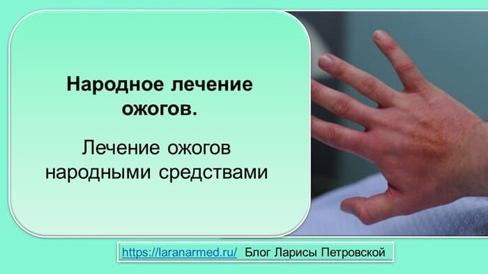 Народное лечение ожогов